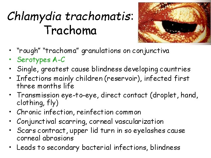 Chlamydia trachomatis: Trachoma • • • “rough” “trachoma” granulations on conjunctiva Serotypes A-C Single,