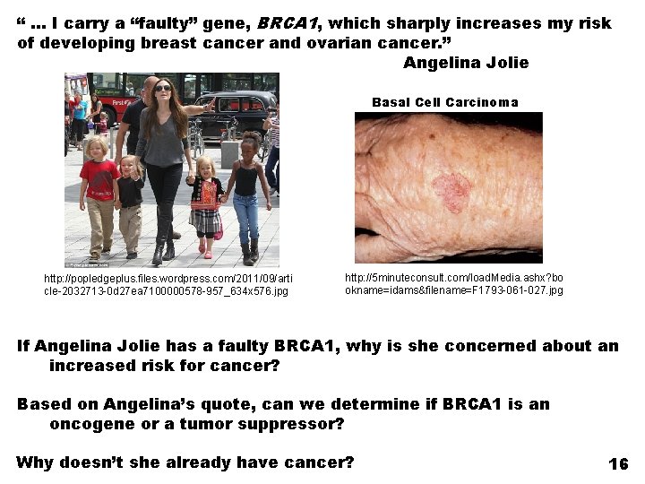“ … I carry a “faulty” gene, BRCA 1, which sharply increases my risk
