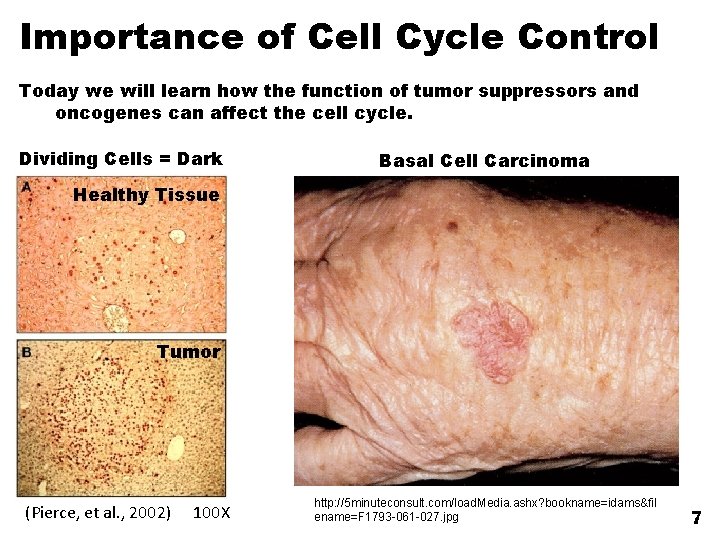 Importance of Cell Cycle Control Today we will learn how the function of tumor