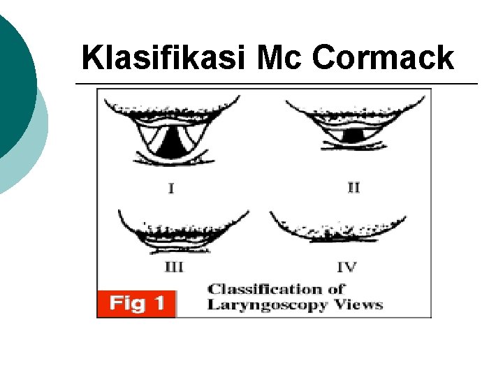 Klasifikasi Mc Cormack 