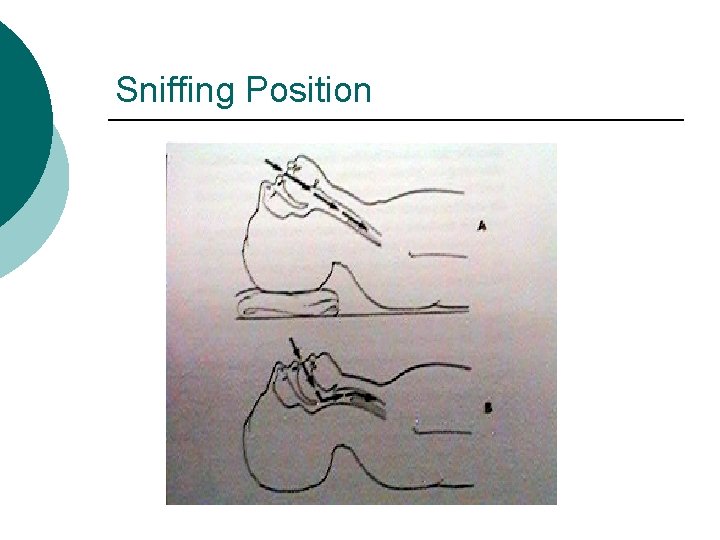 Sniffing Position 