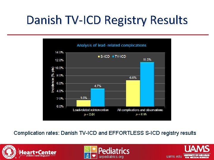 Danish TV-ICD Registry Results Complication rates: Danish TV-ICD and EFFORTLESS S-ICD registry results arpediatrics.