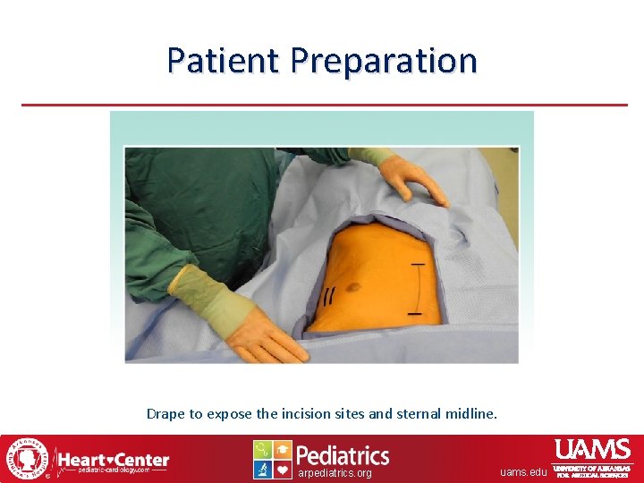 Patient Preparation Drape to expose the incision sites and sternal midline. arpediatrics. org uams.