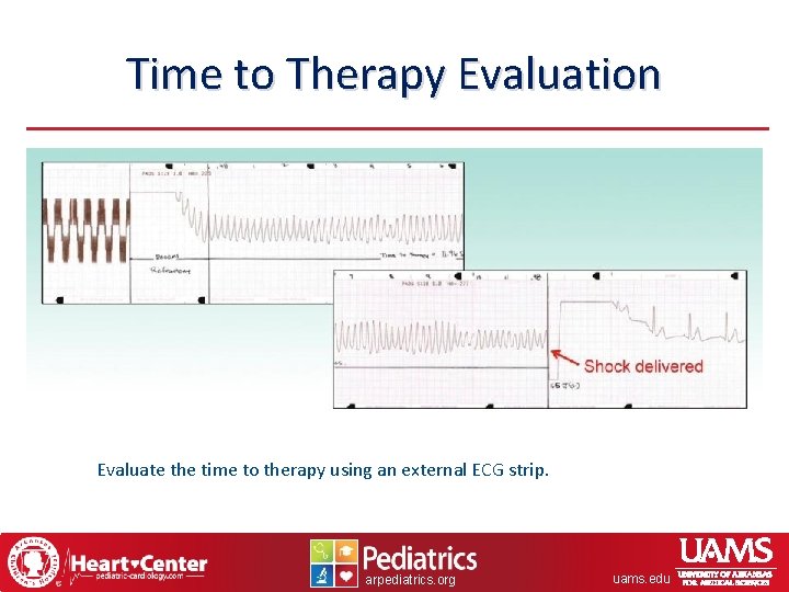 Time to Therapy Evaluation Evaluate the time to therapy using an external ECG strip.