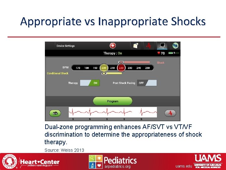 Appropriate vs Inappropriate Shocks Dual-zone programming enhances AF/SVT vs VT/VF discrimination to determine the