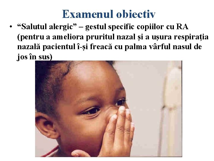 Examenul obiectiv • “Salutul alergic” – gestul specific copiilor cu RA (pentru a ameliora