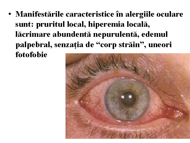  • Manifestările caracteristice în alergiile oculare sunt: pruritul local, hiperemia locală, lăcrimare abundentă