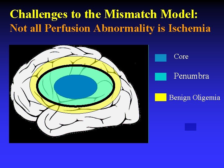 Challenges to the Mismatch Model: Not all Perfusion Abnormality is Ischemia Core Penumbra Benign