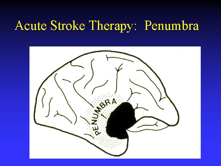 Acute Stroke Therapy: Penumbra 