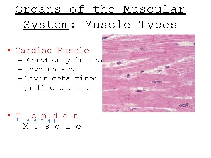 Organs of the Muscular System: Muscle Types • Cardiac Muscle – Found only in Organs of the Muscular System: Muscle Types • Cardiac Muscle – Found only in