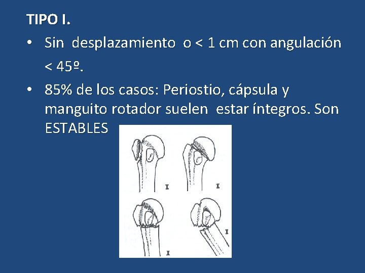 TIPO I. • Sin desplazamiento o < 1 cm con angulación < 45º. •