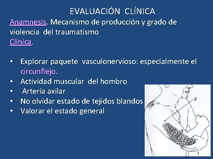 EVALUACIÓN CLÍNICA Anamnesis. Mecanismo de producción y grado de violencia del traumatismo Clínica. •