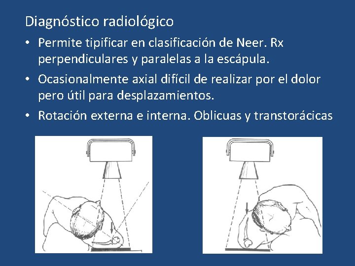 Diagnóstico radiológico • Permite tipificar en clasificación de Neer. Rx perpendiculares y paralelas a