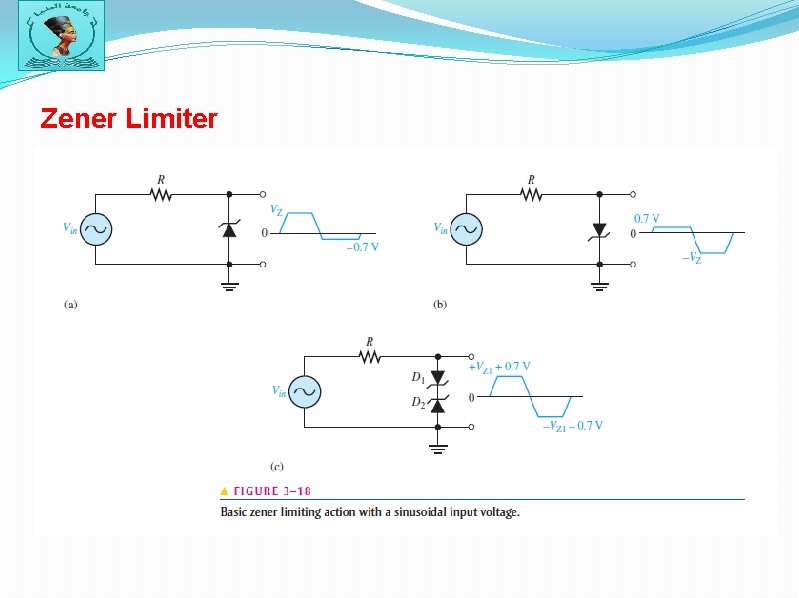 Zener Limiter 