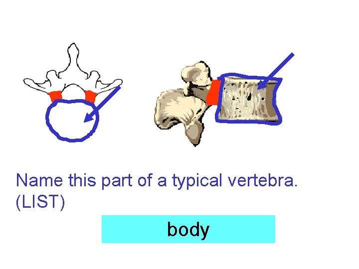 Name this part of a typical vertebra. (LIST) body 