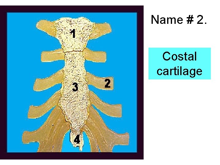 Name # 2. Costal cartilage 