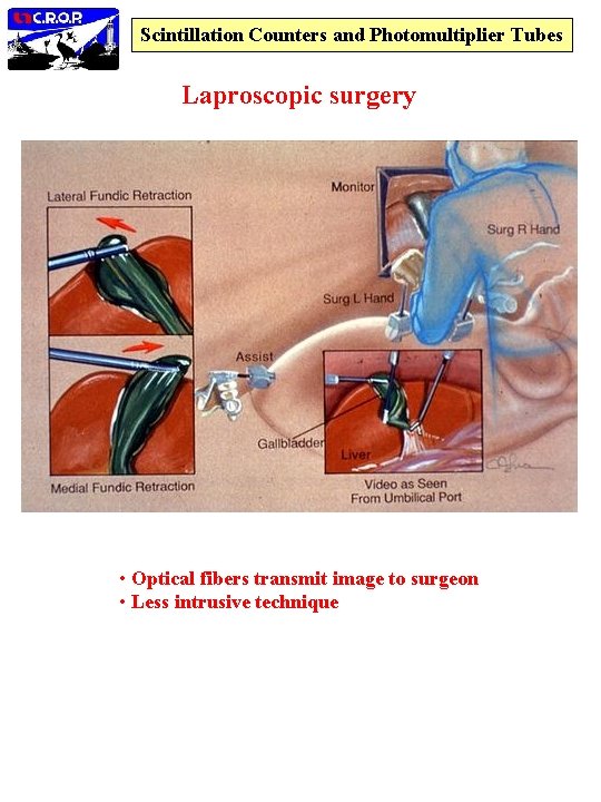Scintillation Counters and Photomultiplier Tubes Laproscopic surgery • Optical fibers transmit image to surgeon