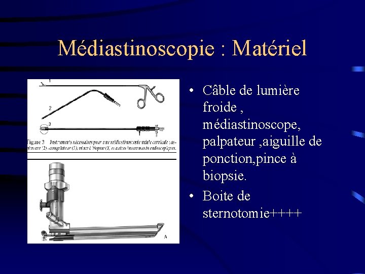 Médiastinoscopie : Matériel • Câble de lumière froide , médiastinoscope, palpateur , aiguille de
