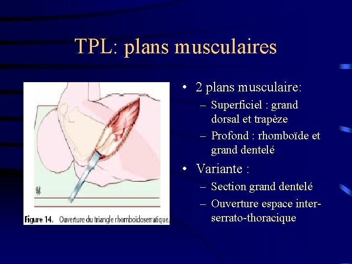 TPL: plans musculaires • 2 plans musculaire: – Superficiel : grand dorsal et trapèze