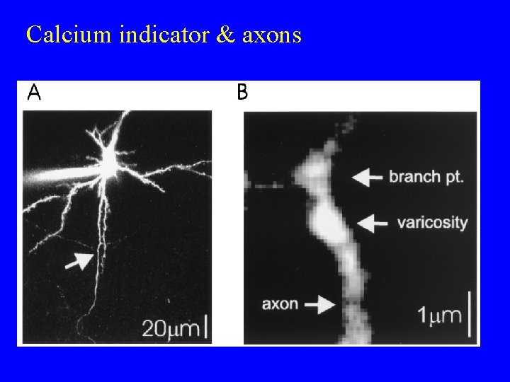 Calcium indicator & axons 