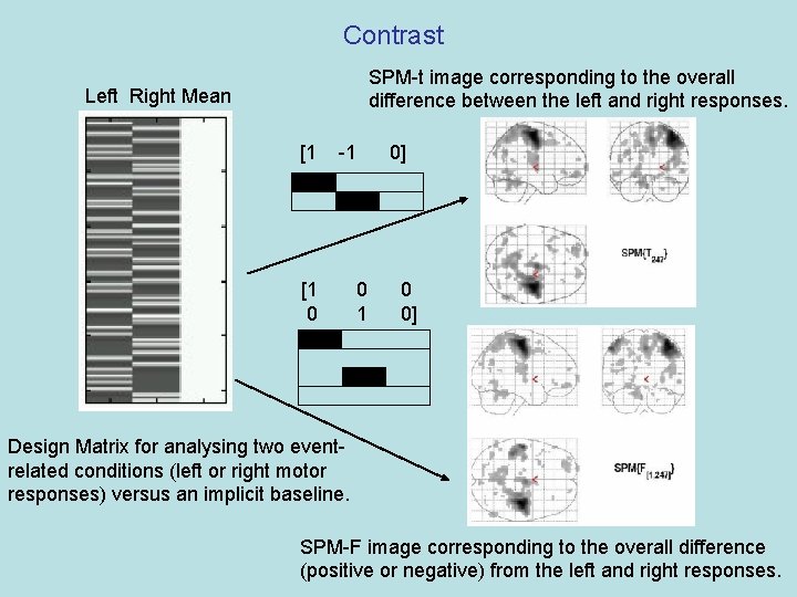 Contrast SPM-t image corresponding to the overall difference between the left and right responses.