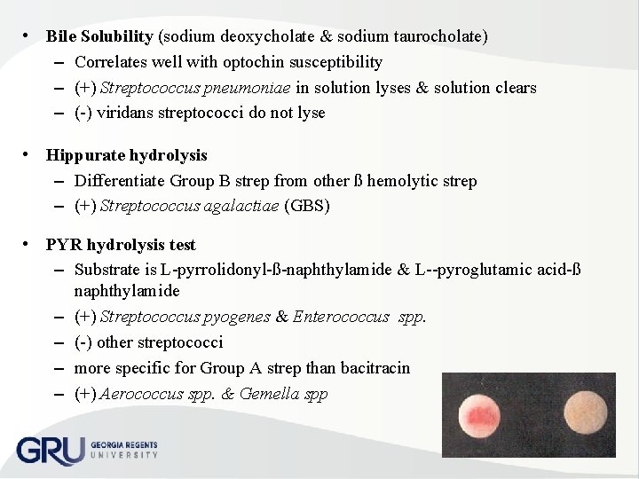  • Bile Solubility (sodium deoxycholate & sodium taurocholate) – Correlates well with optochin