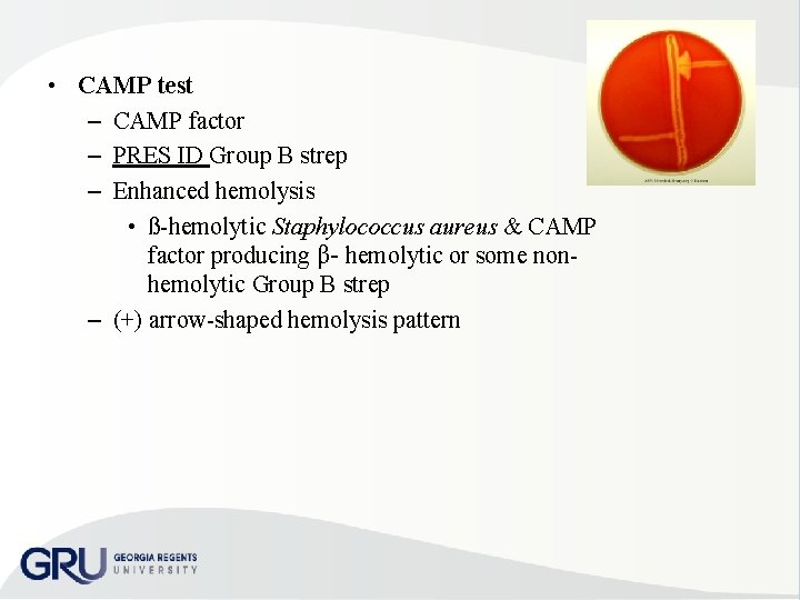  • CAMP test – CAMP factor – PRES ID Group B strep –