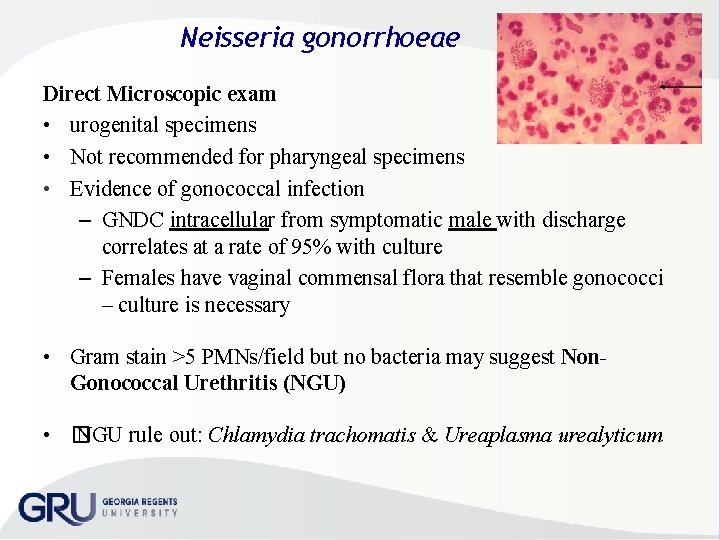Neisseria gonorrhoeae Direct Microscopic exam • urogenital specimens • Not recommended for pharyngeal specimens