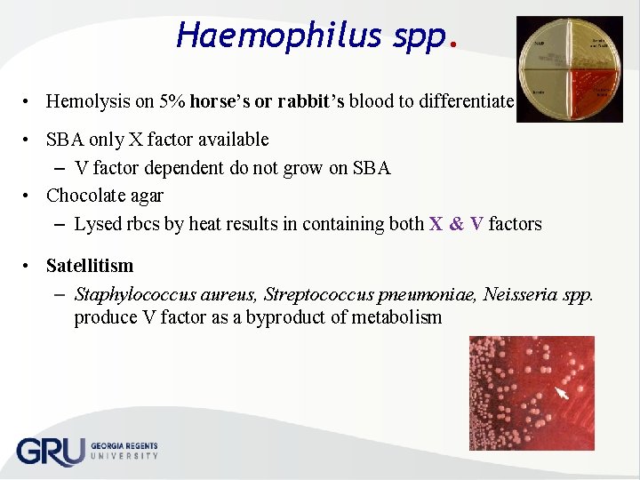 Haemophilus spp. • Hemolysis on 5% horse’s or rabbit’s blood to differentiate • SBA