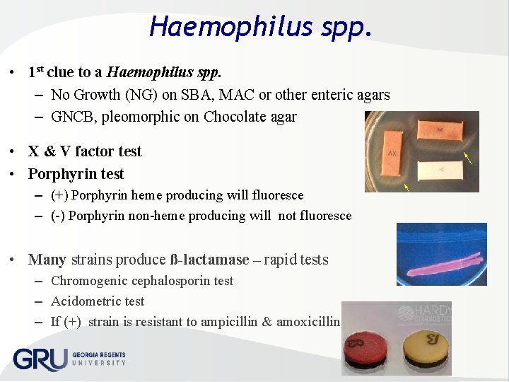 Haemophilus spp. • 1 st clue to a Haemophilus spp. – No Growth (NG)