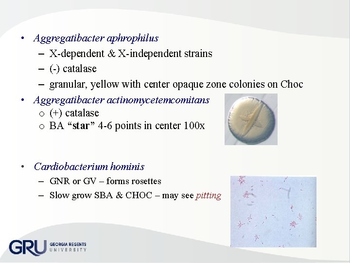  • Aggregatibacter aphrophilus – X dependent & X independent strains – ( )