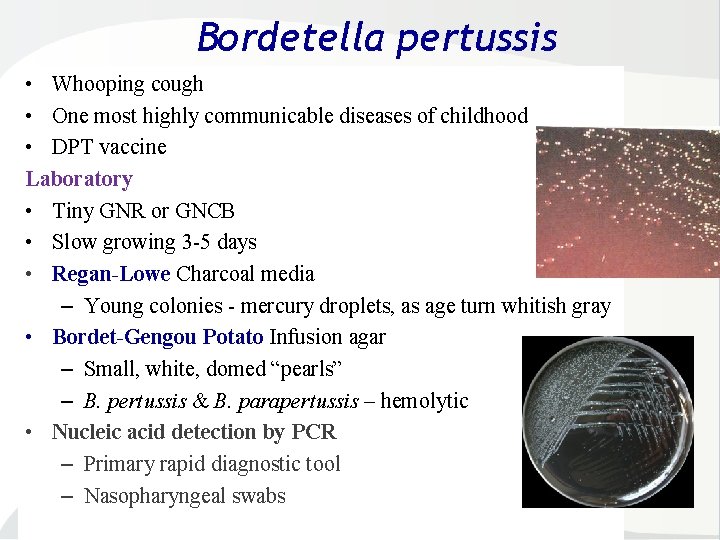 Bordetella pertussis • Whooping cough • One most highly communicable diseases of childhood •