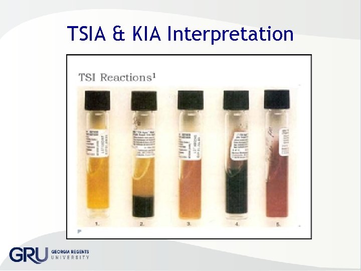 TSIA & KIA Interpretation 