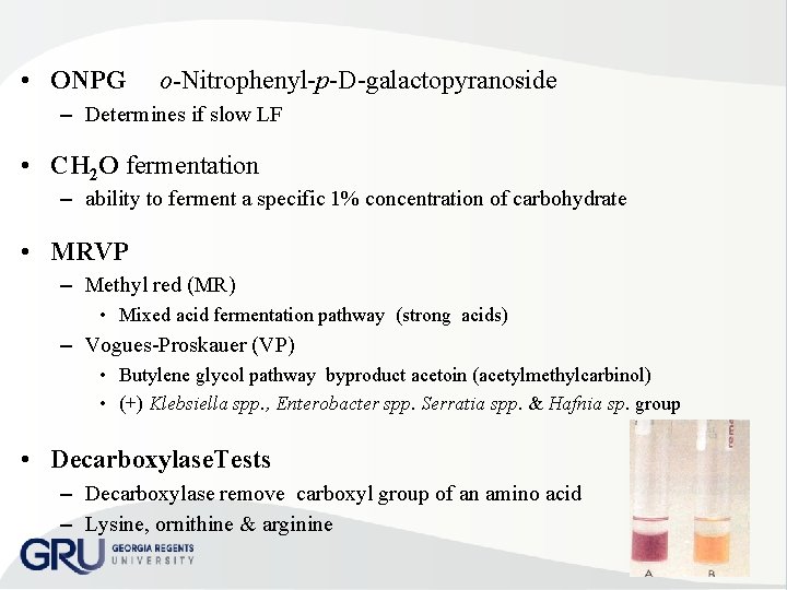  • ONPG o-Nitrophenyl p D galactopyranoside – Determines if slow LF • CH