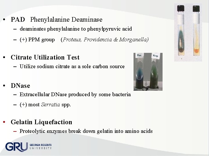  • PAD Phenylalanine Deaminase – deaminates phenylalanine to phenylpyruvic acid – (+) PPM