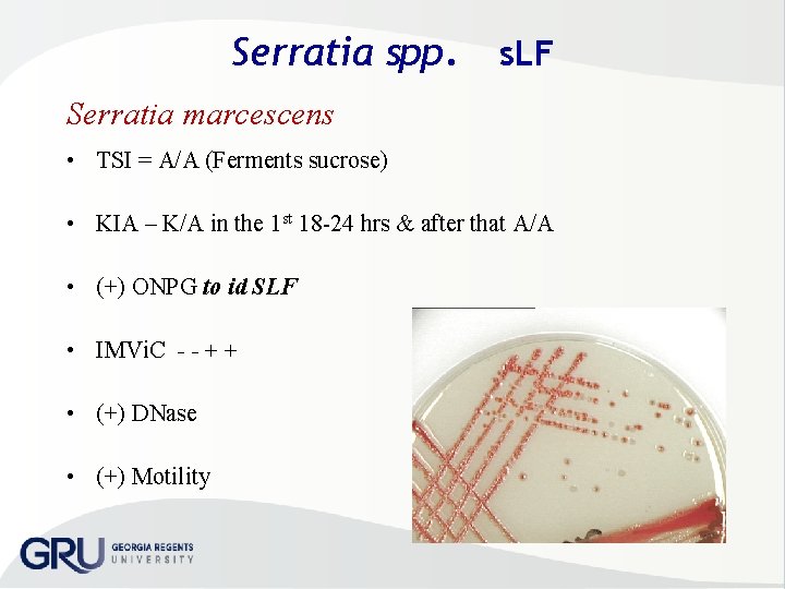 Serratia spp. s. LF Serratia marcescens • TSI = A/A (Ferments sucrose) • KIA