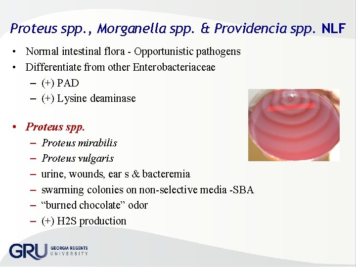 Proteus spp. , Morganella spp. & Providencia spp. NLF • Normal intestinal flora Opportunistic