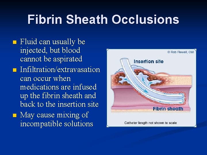 Fibrin Sheath Occlusions n n n Fluid can usually be injected, but blood cannot