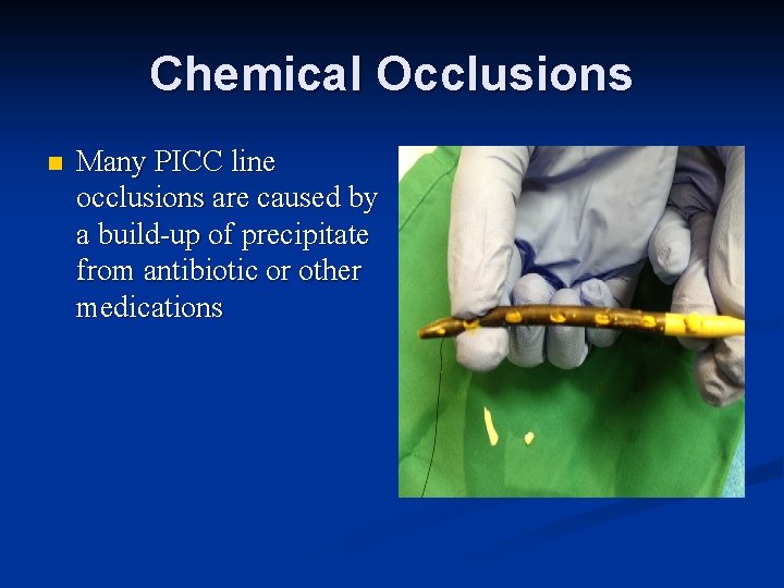 Chemical Occlusions n Many PICC line occlusions are caused by a build-up of precipitate