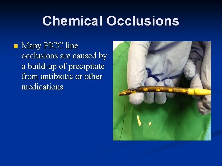 Chemical Occlusions n Many PICC line occlusions are caused by a build-up of precipitate Chemical Occlusions n Many PICC line occlusions are caused by a build-up of precipitate