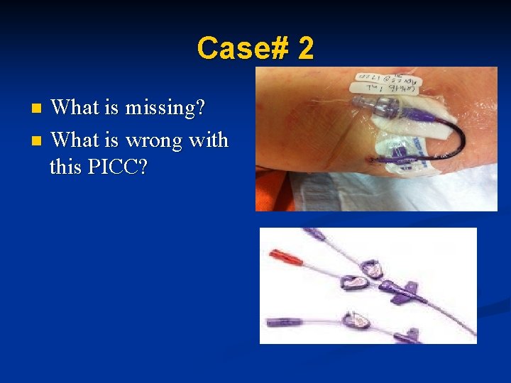 Case# 2 What is missing? n What is wrong with this PICC? n Case# 2 What is missing? n What is wrong with this PICC? n