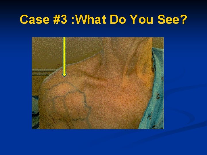 Case #3 : What Do You See? Case #3 : What Do You See?