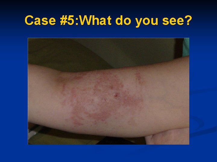 Case #5: What do you see? 