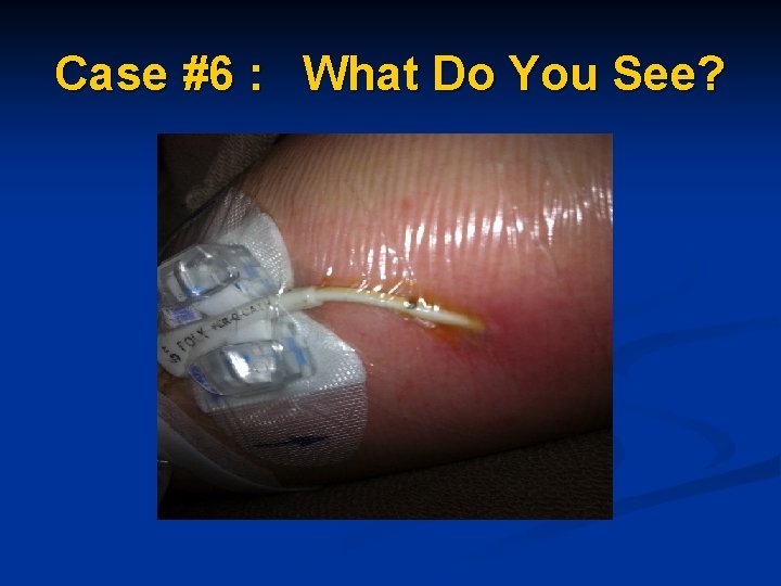 Case #6 : What Do You See? Case #6 : What Do You See?