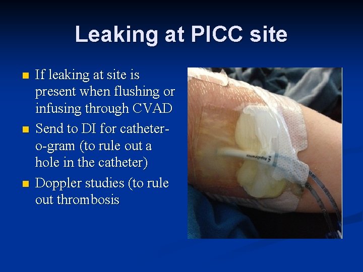Leaking at PICC site n n n If leaking at site is present when