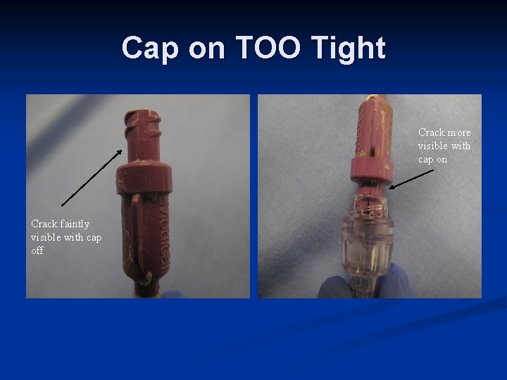 Cap on TOO Tight Crack more visible with cap on Crack faintly visible with