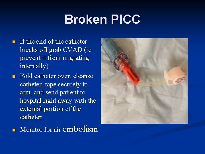 Broken PICC n n n If the end of the catheter breaks off grab