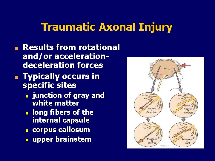 Traumatic Axonal Injury n n Results from rotational and/or accelerationdeceleration forces Typically occurs in
