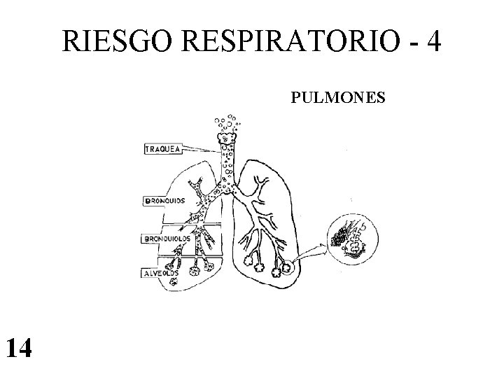 RIESGO RESPIRATORIO - 4 PULMONES 14 