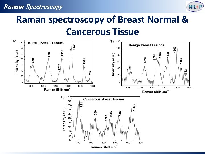 Raman Spectroscopy Raman spectroscopy of Breast Normal & Cancerous Tissue 